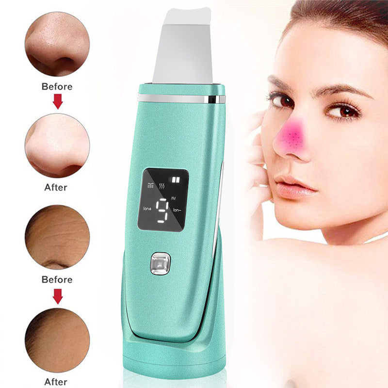Ultrasonic Blackhead Remover Device